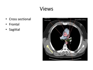 Views
• Cross sectional
• Frontal
• Sagittal
 