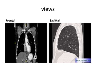 views
Frontal Sagittal
 
