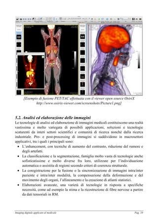 Imaging digitale applicato al medicale Pag. 10
[Esempio di fusione PET/TAC effettuata con il viewer open source OsiriX
http://www.osirix-viewer.com/screenshots/Picture1.png]
5.2. Analisi ed elaborazione delle immagini
Le tecnologie di analisi ed elaborazione di immagini medicali costituiscono una realtà
vastissima e molto variegata di possibili applicazioni, soluzioni e tecnologie
scaturenti da interi settori scientifici e comunità di ricerca nonché dalla ricerca
industriale. Pre- e post-processing di immagini si suddividono in macrosettori
applicativi, tra i quali i principali sono:
• L’enhancement, con tecniche di aumento del contrasto, riduzione del rumore e
degli artefatti.
• La classificazione e la segmentazione, famiglia molto vasta di tecnologie anche
sofisticatissime e molto diverse fra loro, utilizzate per l’individuazione
automatica o assistita di regioni secondo criteri di coerenza strutturale.
• La coregistrazione per la fusione o la sincronizzazione di immagini intra/inter
paziente e intra/inter modalità, la compensazione della deformazione e del
movimento degli organi, l’allineamento e la creazione di atlanti statistici.
• Elaborazioni avanzate, una varietà di tecnologie in risposta a specifiche
necessità, come ad esempio la stima e la ricostruzione di fibre nervose a partire
da dati tensoriali in RM.
 