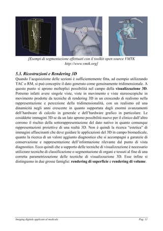 Imaging digitale applicato al medicale Pag. 11
[Esempi di segmentazione effettuati con il toolkit open source VMTK
http://www.vmtk.org]
5.3. Ricostruzioni e Rendering 3D
Quando l’acquisizione delle sezioni è sufficientemente fitta, ad esempio utilizzando
TAC o RM, si può concepire il dato generato come genuinamente tridimensionale. A
questo punto si aprono molteplici possibilità nel campo della visualizzazione 3D.
Potremo infatti avere singole viste, viste in movimento e viste stereoscopiche in
movimento prodotte da tecniche di rendering 3D in un crescendo di realismo nella
rappresentazione e percezione della tridimensionalità, con un realismo ed una
dinamicità negli anni crescente in quanto supportata dagli enormi avanzamenti
dell’hardware di calcolo in generale e dell’hardware grafico in particolare. Le
cosiddette immagini 3D se da un lato aprono possibilità nuove per il clinico dall’altro
corrono il rischio della sottorappresentazione del dato nativo in quanto comunque
rappresentazioni proiettive di una realtà 3D. Non è quindi la ricerca “estetica” di
immagini affascinanti che deve guidare le applicazioni del 3D in campo biomedicale,
quanto la ricerca di un valore aggiunto diagnostico che si accompagni a garanzie di
conservazione e rappresentazione dell’informazione rilevante dal punto di vista
diagnostico. Ecco quindi che a supporto delle tecniche di visualizzazione è necessario
utilizzare tecniche di classificazione o segmentazione di organi e tessuti al fine di una
corretta parametrizzazione delle tecniche di visualizzazione 3D. Esse infine si
distinguono in due grosse famiglie: rendering di superficie e rendering di volume.
 