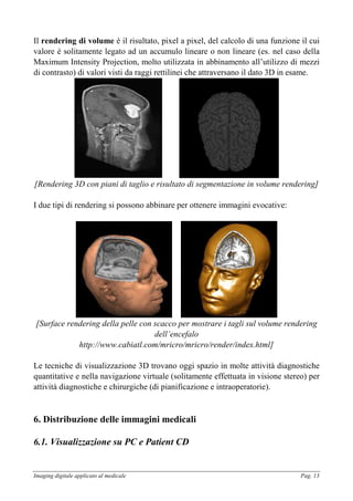 Imaging digitale applicato al medicale Pag. 13
Il rendering di volume è il risultato, pixel a pixel, del calcolo di una funzione il cui
valore è solitamente legato ad un accumulo lineare o non lineare (es. nel caso della
Maximum Intensity Projection, molto utilizzata in abbinamento all’utilizzo di mezzi
di contrasto) di valori visti da raggi rettilinei che attraversano il dato 3D in esame.
[Rendering 3D con piani di taglio e risultato di segmentazione in volume rendering]
I due tipi di rendering si possono abbinare per ottenere immagini evocative:
[Surface rendering della pelle con scacco per mostrare i tagli sul volume rendering
dell’encefalo
http://www.cabiatl.com/mricro/mricro/render/index.html]
Le tecniche di visualizzazione 3D trovano oggi spazio in molte attività diagnostiche
quantitative e nella navigazione virtuale (solitamente effettuata in visione stereo) per
attività diagnostiche e chirurgiche (di pianificazione e intraoperatorie).
6. Distribuzione delle immagini medicali
6.1. Visualizzazione su PC e Patient CD
 