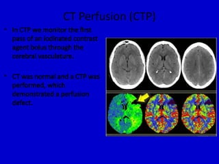 Stroke Evaluation in the light of Radiological view.pptx