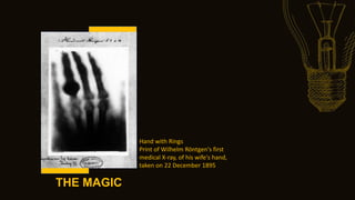 THE MAGIC
Hand with Rings
Print of Wilhelm Röntgen's first
medical X-ray, of his wife's hand,
taken on 22 December 1895
 