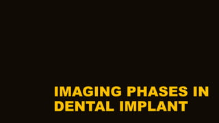 IMAGING PHASES IN
DENTAL IMPLANT
 