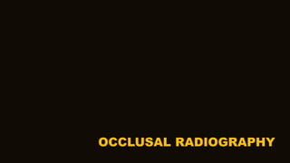 OCCLUSAL RADIOGRAPHY
 