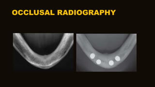 OCCLUSAL RADIOGRAPHY
 