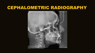 CEPHALOMETRIC RADIOGRAPHY
 