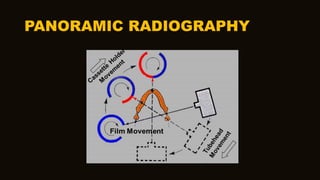 PANORAMIC RADIOGRAPHY
 