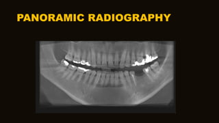 PANORAMIC RADIOGRAPHY
 