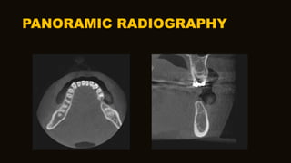 PANORAMIC RADIOGRAPHY
 