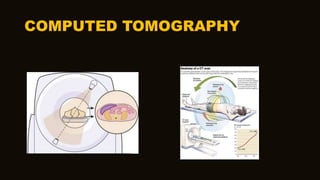 COMPUTED TOMOGRAPHY
 