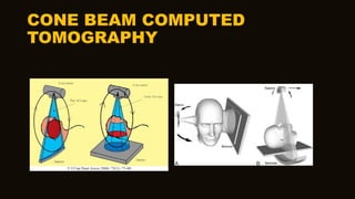 CONE BEAM COMPUTED
TOMOGRAPHY
 