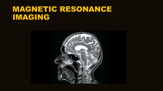 MAGNETIC RESONANCE
IMAGING
 