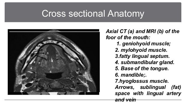 Imaging For The Oral Cavity Neoplastic Lesions Final
