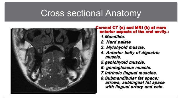 Imaging For The Oral Cavity Neoplastic Lesions Final