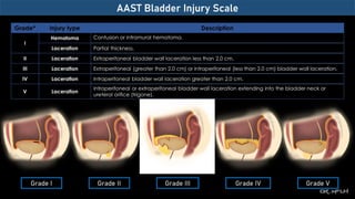 Imaging Genitourinary Trauma.pdf