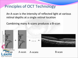 Principles of OCT Technology
An A-scan is the intensity of reflected light at various
retinal depths at a single retinal location
Combining many A-scans produces a B-scan
A-scan A-scan
+ + . . . =
B-scanA-scans
RetinalDepth
Reflectance Intensity
 