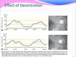 Effect of Decentration
 