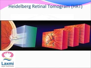 Heidelberg Retinal Tomogram (HRT)
 