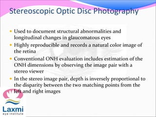 Stereoscopic Optic Disc Photography
 Used to document structural abnormalities and
longitudinal changes in glaucomatous eyes
 Highly reproducible and records a natural color image of
the retina
 Conventional ONH evaluation includes estimation of the
ONH dimensions by observing the image pair with a
stereo viewer
 In the stereo image pair, depth is inversely proportional to
the disparity between the two matching points from the
left and right images
 