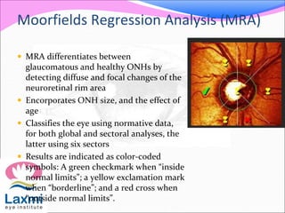 Moorfields Regression Analysis (MRA)
 MRA differentiates between
glaucomatous and healthy ONHs by
detecting diffuse and focal changes of the
neuroretinal rim area
 Encorporates ONH size, and the effect of
age
 Classifies the eye using normative data,
for both global and sectoral analyses, the
latter using six sectors
 Results are indicated as color-coded
symbols: A green checkmark when “inside
normal limits”; a yellow exclamation mark
when “borderline”; and a red cross when
“outside normal limits”.
 