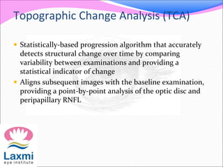 Topographic Change Analysis (TCA)
 Statistically-based progression algorithm that accurately
detects structural change over time by comparing
variability between examinations and providing a
statistical indicator of change
 Aligns subsequent images with the baseline examination,
providing a point-by-point analysis of the optic disc and
peripapillary RNFL
 