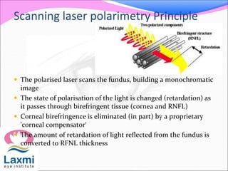 Scanning laser polarimetry Principle
 The polarised laser scans the fundus, building a monochromatic
image
 The state of polarisation of the light is changed (retardation) as
it passes through birefringent tissue (cornea and RNFL)
 Corneal birefringence is eliminated (in part) by a proprietary
'corneal compensator‘
 The amount of retardation of light reflected from the fundus is
converted to RFNL thickness
 