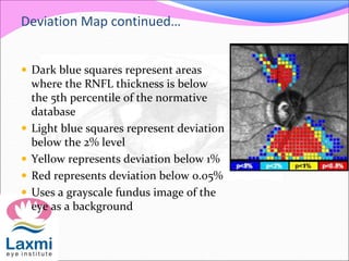 Deviation Map continued…
 Dark blue squares represent areas
where the RNFL thickness is below
the 5th percentile of the normative
database
 Light blue squares represent deviation
below the 2% level
 Yellow represents deviation below 1%
 Red represents deviation below 0.05%
 Uses a grayscale fundus image of the
eye as a background
 