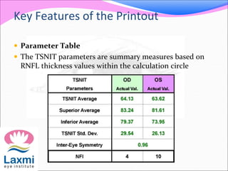 Key Features of the Printout
 Parameter Table
 The TSNIT parameters are summary measures based on
RNFL thickness values within the calculation circle
 