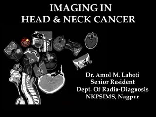 IMAGING IN
HEAD & NECK CANCER
Dr. Amol M. Lahoti
Senior Resident
Dept. Of Radio-Diagnosis
NKPSIMS, Nagpur
 