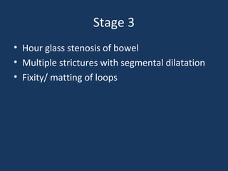 Stage 3
• Hour glass stenosis of bowel
• Multiple strictures with segmental dilatation
• Fixity/ matting of loops
 