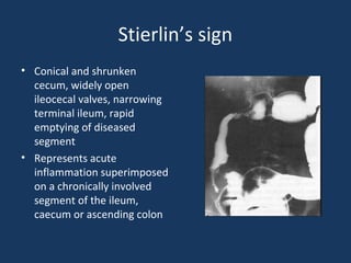 Stierlin’s sign
• Conical and shrunken
cecum, widely open
ileocecal valves, narrowing
terminal ileum, rapid
emptying of diseased
segment
• Represents acute
inflammation superimposed
on a chronically involved
segment of the ileum,
caecum or ascending colon
 