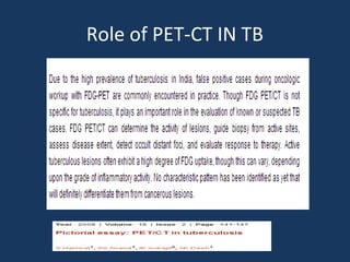 Role of PET-CT IN TB
 