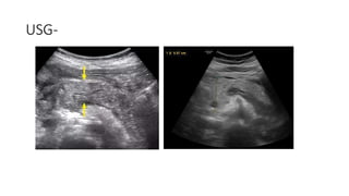 Acnormal Usg Week Comprehensive Imaging Techniques for Diagnosing Acute Abdomen ...