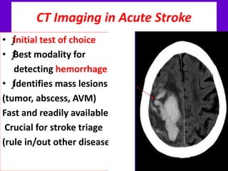 CT Imaging in Acute Stroke
• ƒInitial test of choice
• ƒBest modality for
detecting hemorrhage
• ƒIdentifies mass lesions
(tumor, abscess, AVM)
Fast and readily available
Crucial for stroke triage
(rule in/out other diseases)
 