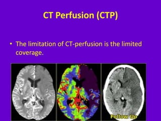 Imaging in acute stroke | PPTX
