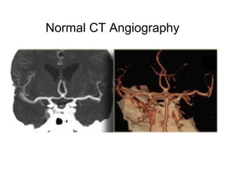 Normal CT Angiography
 