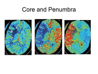 Core and Penumbra
 