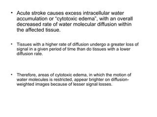 • Acute stroke causes excess intracellular water
accumulation or “cytotoxic edema”, with an overall
decreased rate of water molecular diffusion within
the affected tissue.
• Tissues with a higher rate of diffusion undergo a greater loss of
signal in a given period of time than do tissues with a lower
diffusion rate.
• Therefore, areas of cytotoxic edema, in which the motion of
water molecules is restricted, appear brighter on diffusion-
weighted images because of lesser signal losses.
 