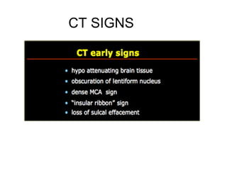 CT SIGNS
 