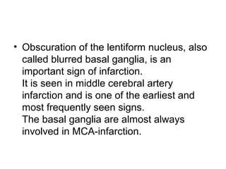 • Obscuration of the lentiform nucleus, also
called blurred basal ganglia, is an
important sign of infarction.
It is seen in middle cerebral artery
infarction and is one of the earliest and
most frequently seen signs.
The basal ganglia are almost always
involved in MCA-infarction.
 