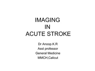 IMAGING
IN
ACUTE STROKE
Dr Anoop.K.R
Asst professor
General Medicine
MMCH,Calicut
 