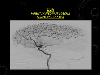 DSA
PATIENT SHIFTED IN AT 10:30PM
PUNCTURE – 10:35PM
 