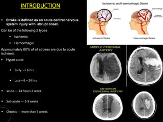 INTRODUCTION
 Stroke is defined as an acute central nervous
system injury with abrupt onset.
Can be of the following 2 types
 Ischemic
 Hemorrhagic
Approximately 80% of all strokes are due to acute
ischemia
 Hyper acute
 Early - < 6 hrs
 Late – 6 – 24 hrs
 acute --- 24 hours-1week
 Sub acute --- 1-3 weeks
 Chronic --- more than 3 weeks
 