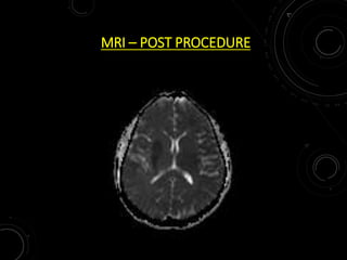 MRI – POST PROCEDURE
 