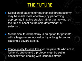 THE FUTURE
 Selection of patients for mechanical thrombectomy
may be made more effectively by performing
appropriate imaging studies rather than relying on
the time of onset as the sole determinant of
selection.
 Mechanical thrombectomy is an option for patients
with a large vessel occlusion by a long thrombus
causing a severe stroke.
 Image wisely to save lives for the patients who are in
ischemic stroke and a protocol must be set in
hospital when dealing with ischemic stroke.
 