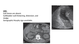 imaging in biliary tract presentation... | PPTX