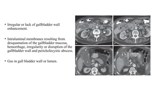 imaging in biliary tract presentation... | PPTX