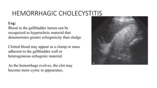 imaging in biliary tract presentation... | PPTX