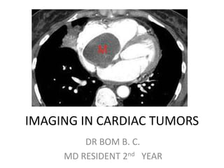 IMAGING IN CARDIAC TUMORS
DR BOM B. C.
MD RESIDENT 2nd YEAR
 